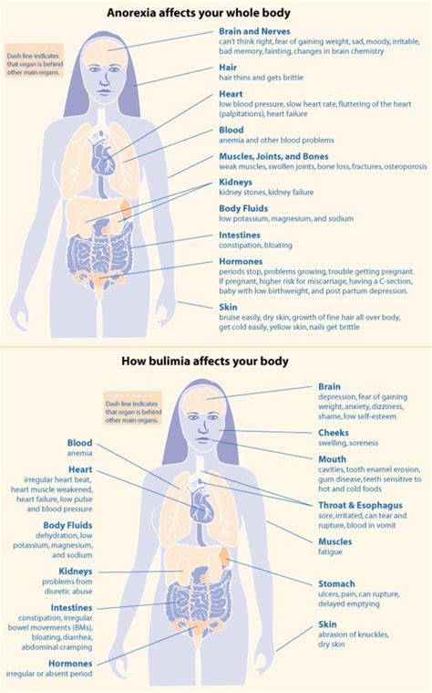 anorexia vs bulimia|signs and symptoms of anorexia and bulimia.